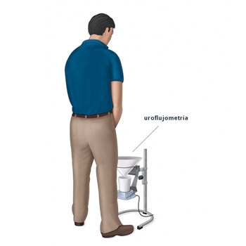 uroflujometría caracas guatire